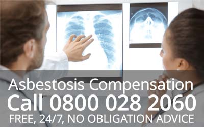 Types and Stages of Asbestosis Types and Stages of Asbestosis